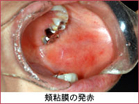 �ʐ^�F�j�S���̔���