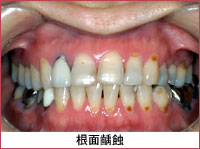 �ʐ^�F����ꚐI