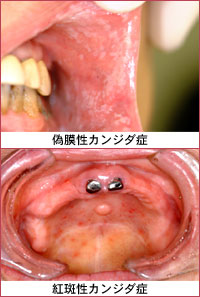 �ʐ^�F�U�����J���W�_�ǂƍg�����J���W�_��