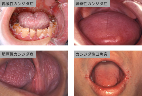 �J���W�_�ǂ̎��