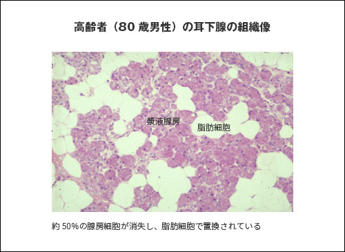 ����ҁi80�Βj���j�̎����B�̑g�D��