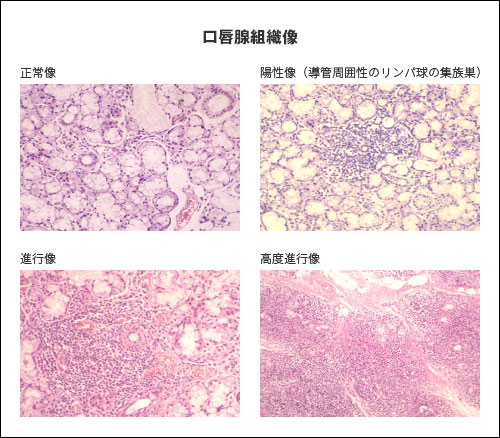 ���O�B�g�D��