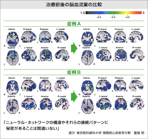 ���ÑO��̔]�����ʂ̔�r�̐}